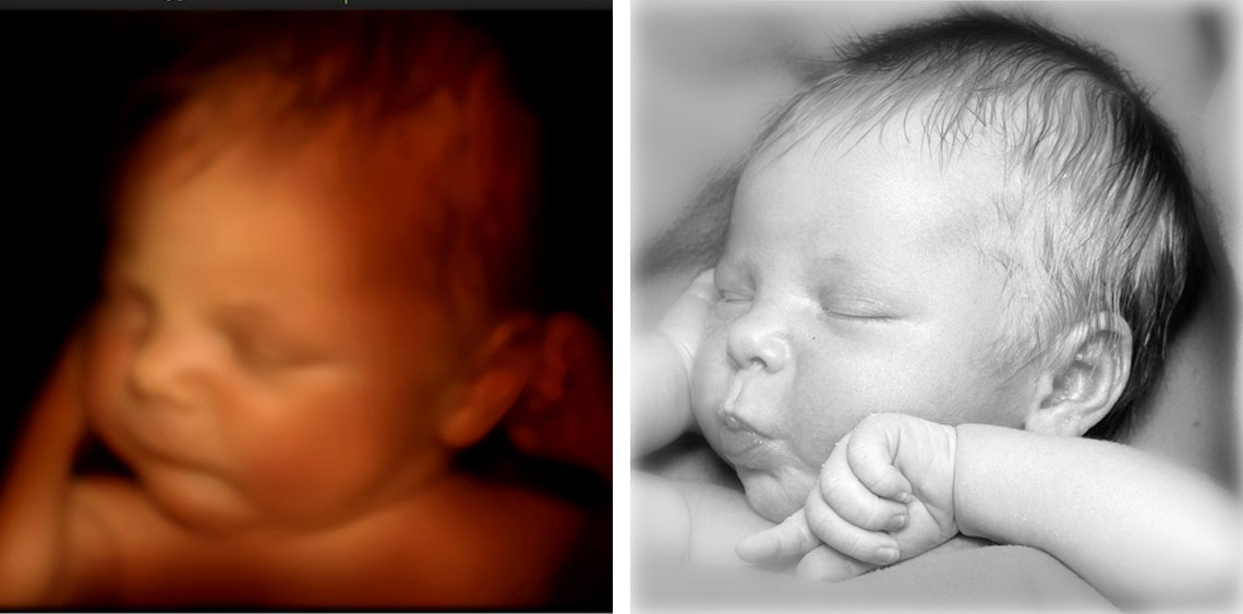 Amazing unborn baby ultrasound and newborn baby picture